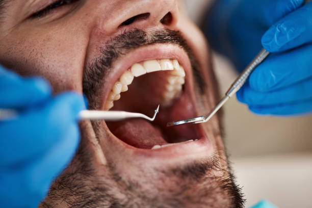 Best Dental Abscess Treatment in Kenvil, NJ